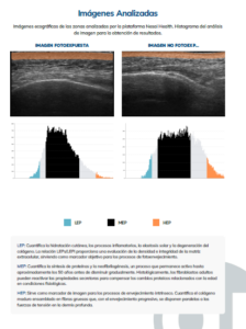 ventajas NESAI DERM informes ecográficos en Martorell