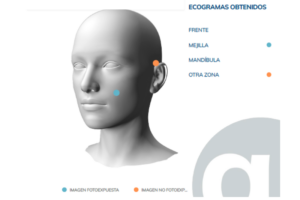 informe NESAI DERM en De Cabo Bové
