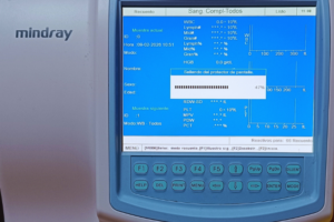 alopecia androgenética: tecnología avanzada para tratarla en Martorell